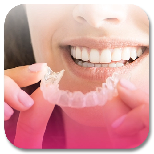 dental aligners