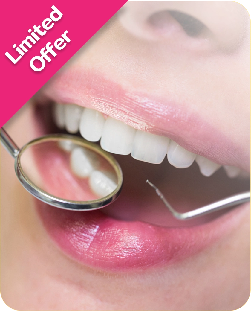 special cleaning full mouth